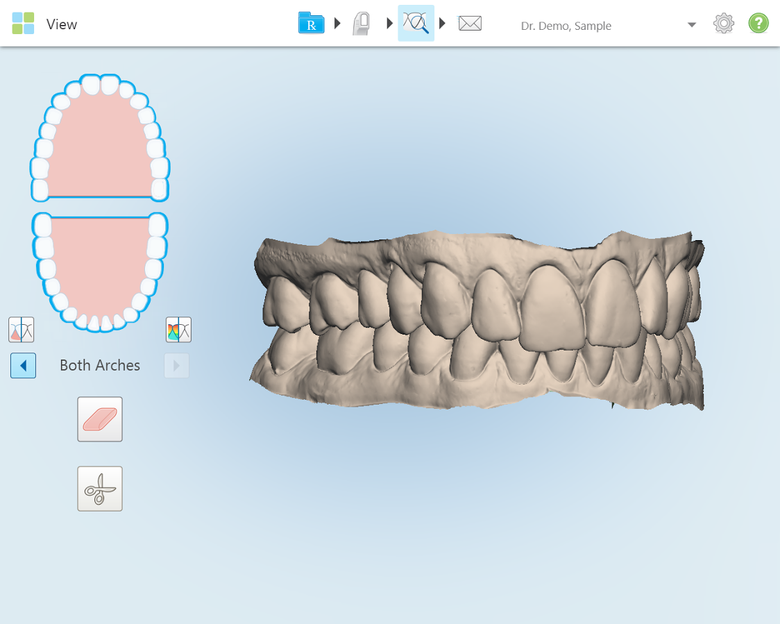 why-youre-likely-an-ideal-candidate-for-invisalign-3d-model-2